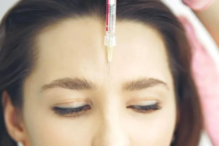 Una jeringa con aguja fina se acerca a la frente de una mujer, mostrando el procedimiento de **que es el botox** para suavizar arrugas.