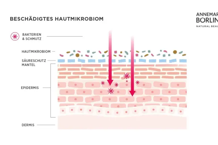 Illustration zeigt ein geschädigtes Hautmikrobiom mit Bakterien und Schmutz, die in die Epidermis eindringen.