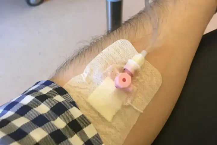 Ramię z wenflonem i plastrem, przygotowane do podania leku.