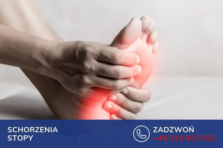 Dłoń uciska bolesną stopę, sugerując problem ze stopą Mortona.
