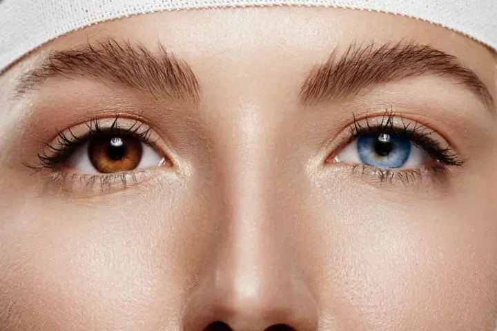 Oczy z heterochromią: jedno brązowe, drugie niebieskie. Delikatna opaska na głowie.