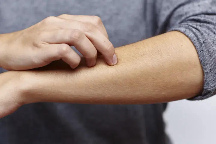 Juckende Haut am Arm, ein mögliches Symptom bei zu viel Zink.