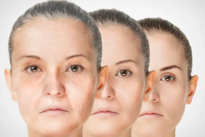 Trois visages de femmes montrant le processus de régénération de la peau, du plus âgé au plus jeune.