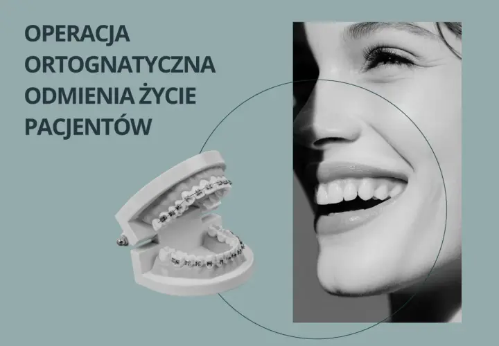 Model szczęki z aparatem ortodontycznym i uśmiechnięta twarz. Operacja ortognatyczna odmienia życie pacjentów.
