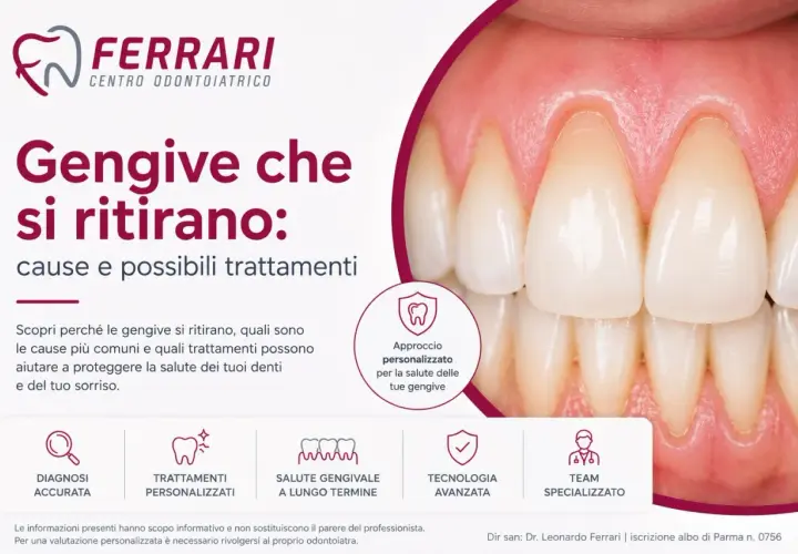 Primo piano di denti sani con gengive rosa, ma il testo "Gengive che si ritirano" suggerisce un problema comune.