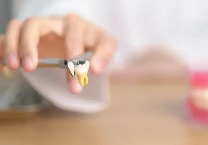 Un dente estratto con pinze, un monito per chi teme di rimanere senza denti a 40 anni.