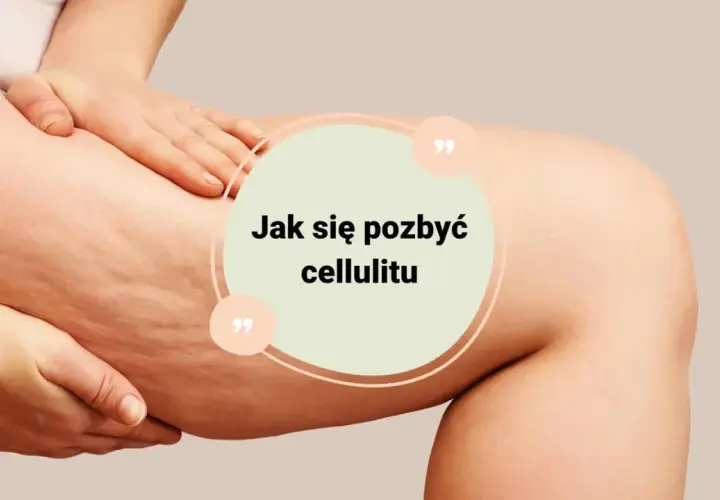Jak pozbyć się cellulitu? Skuteczne metody i zabiegi przewodnik.