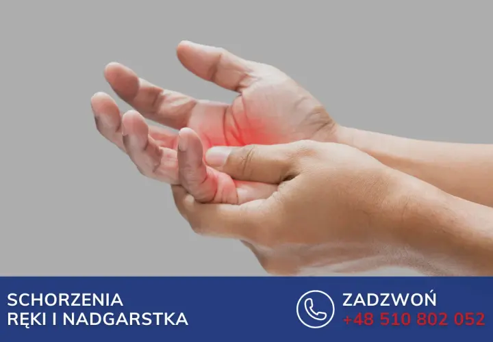 Dłoń z zaczerwienieniem na palcu, wskazującym na zapalenie pochewki ścięgna zginacza palca. Leczenie schorzeń ręki i nadgarstka.