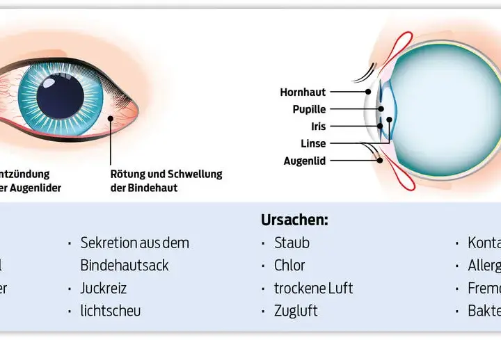 Wirksame Medikamente gegen Bindehautentzündung: Tipps und Empfehlungen