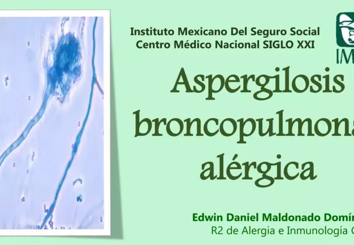 Microscopía de Aspergillus fumigatus, causante de aspergilosis broncopulmonar alérgica.