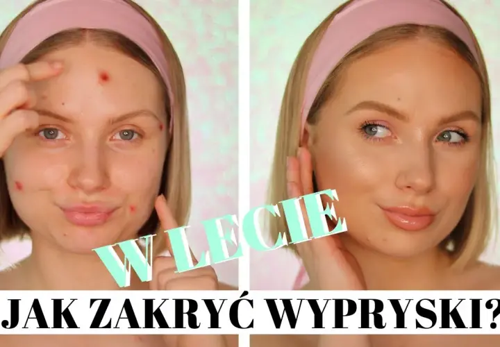 Pryszcze bez makijażu? Szybkie triki na natychmiastowy kamuflaż!