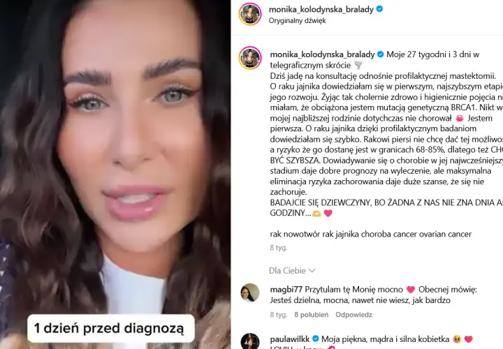 Wczesne objawy raka jajnika, które mogą uratować życie kobietom