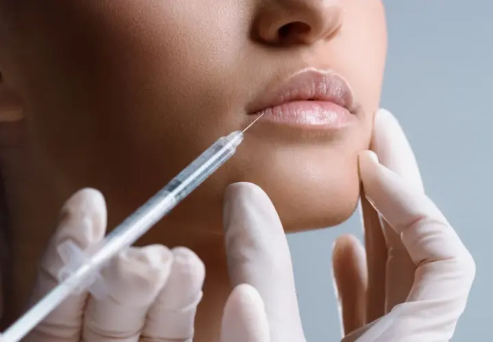 Ile kosztuje botox ust? Ceny zabiegów w Polsce i co wpływa na koszt