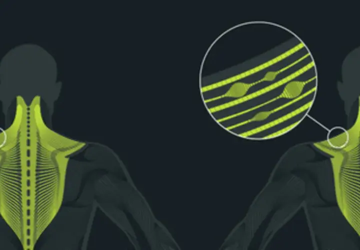 Illustration anatomique montrant des points de tension musculaire, avec un zoom sur des fibres tendues. La traduction de "trigger point" est ici illustrée.