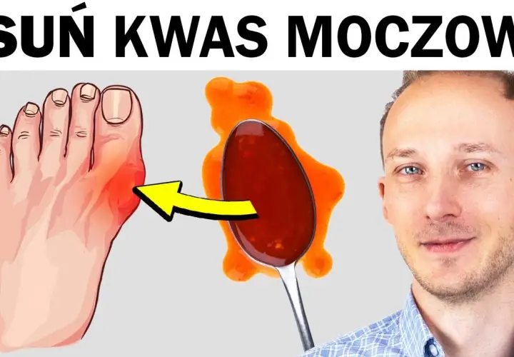 Jak obniżyć kwas moczowy? Sprawdź domowe soki na dnę moczanową