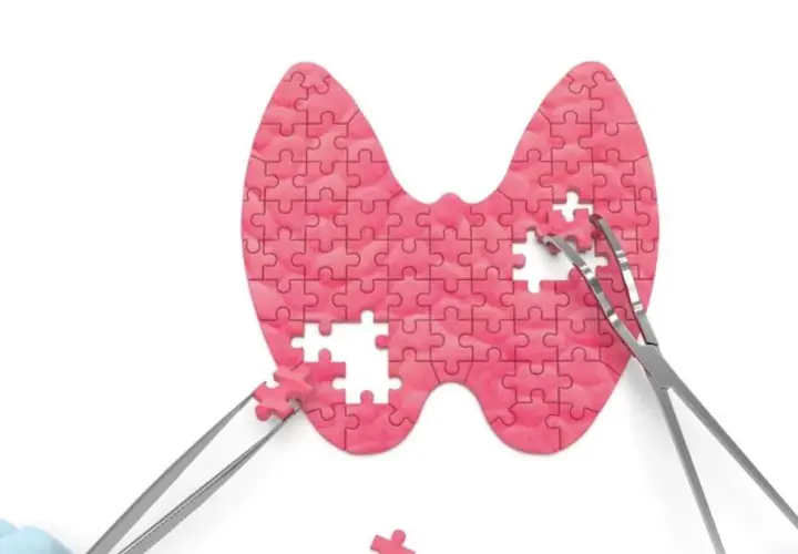 Tarczyca z puzzli, z brakującymi elementami i narzędziami chirurgicznymi. Symbolizuje problemy z hormonami tarczycy, np. niskie TSH.