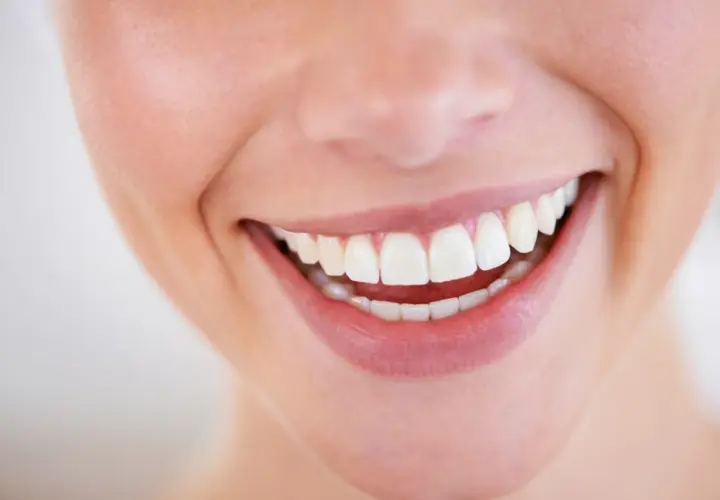 Sorriso smagliante con denti bianchi e perfetti, un vero spettacolo **male al dente** non è un problema qui.