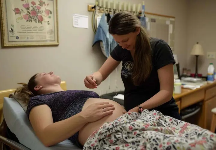 Une praticienne applique des aiguilles d'acupuncture sur le ventre d'une femme enceinte, une approche douce pour l'accouchement.