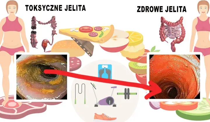 Jak odbudować jelita? 7 skutecznych sposobów na zdrowy mikrobiom