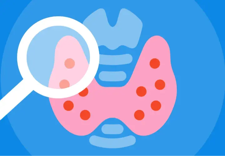 Ilustracja przedstawia tarczycę pod lupą, sugerującą diagnostykę subklinicznej niedoczynności tarczycy.