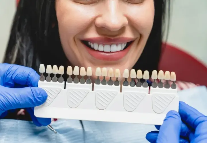 Uśmiechnięta kobieta z idealnymi zębami, dentysta pokazuje paletę kolorów do wyboru najtańszych licówek na zęby.