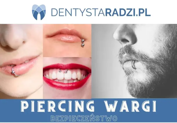 Kolczyk Smiley: Uśmiechnięty sekret wędzidełka. Czy jest bezpieczny?
