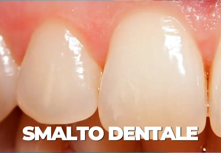 Primo piano di denti sani, con smalto lucido e gengive rosa. Un esempio di smalto dentale forte, pronto per la remineralizzazione.