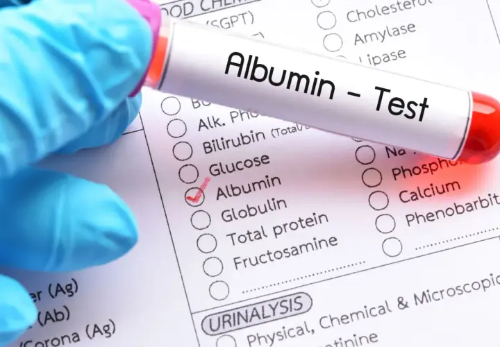 Rękawiczka w niebieskiej rękawiczce trzyma probówkę z napisem "Albumin - Test". Obok zaznaczono "Albumin" na liście badań.