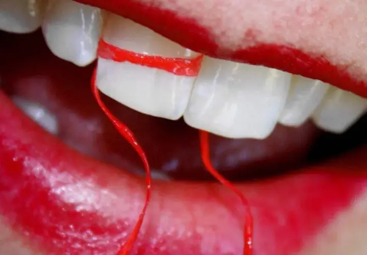 Denti bianchi con filo interdentale rosso stretto tra due, sembra che il filo interdentale faccia male.