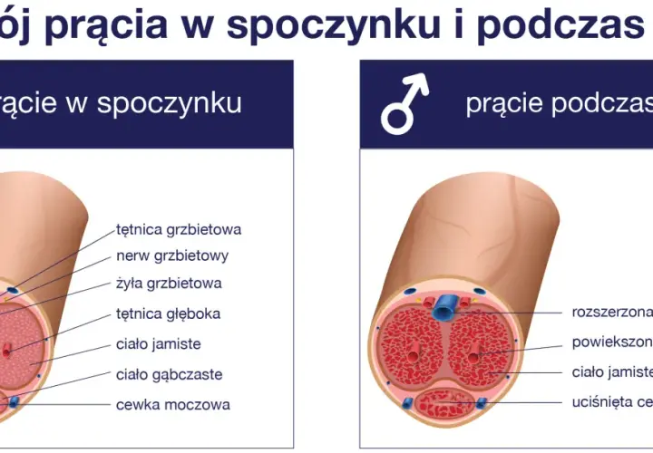 Przekrój prącia w spoczynku i podczas erekcji. Brak erekcji może być oznaką impotencji, co ilustruje obraz.