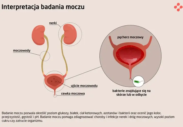 Schemat układu moczowego z zaznaczonym pęcherzem moczowym. Obok widok bakterii.