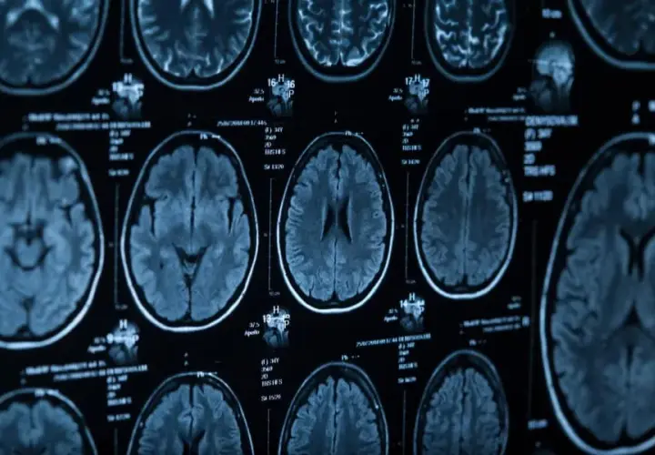 Ile się czeka na wynik tomografii głowy? Sprawdź czas oczekiwania