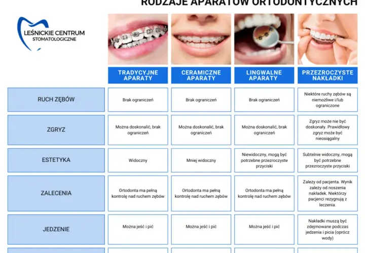 Aparat ortodontyczny: Rodzaje, ceny jak wybrać idealny?