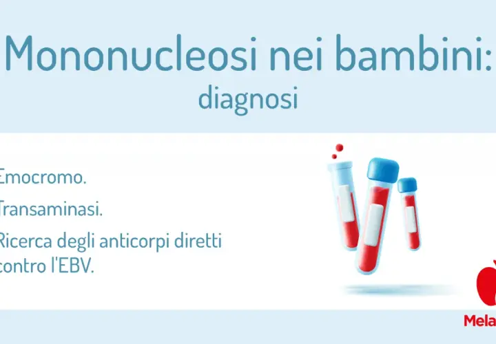 Diagnosi di mononucleosi nei bambini: emocromo, transaminasi e ricerca anticorpi contro l'EBV (Epstein Barr virus).