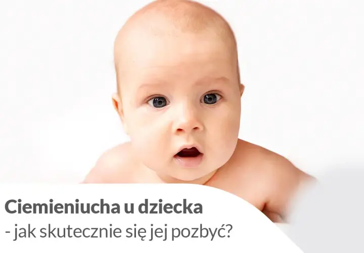 Urocze niemowlę z zaciekawioną miną. Tekst informuje o ciemieniuchy u dziecka i sposobach jej usuwania.