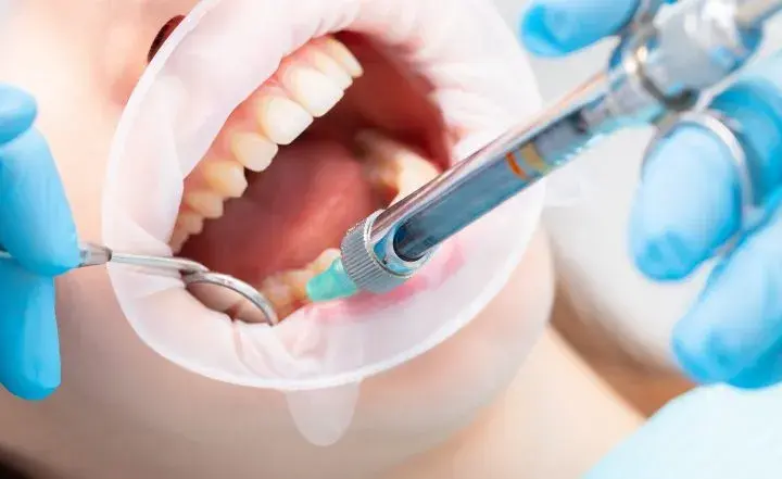 Ile godzin trzyma znieczulenie u dentysty? Co musisz wiedzieć, aby uniknąć bólu