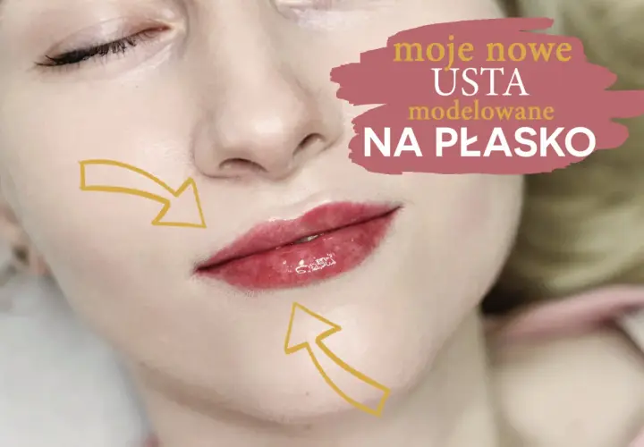 Moje nowe USTA 0.5ml przed i po. Modelowanie na płasko z zaznaczonymi obszarami.