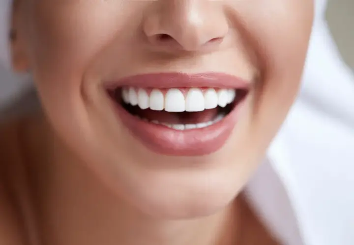 Jak usunąć kamień nazębny bez dentysty - skuteczne domowe metody