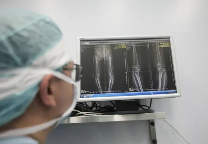 Chirurg w masce i czepku analizuje na monitorze zdjęcia RTG kończyn dolnych.