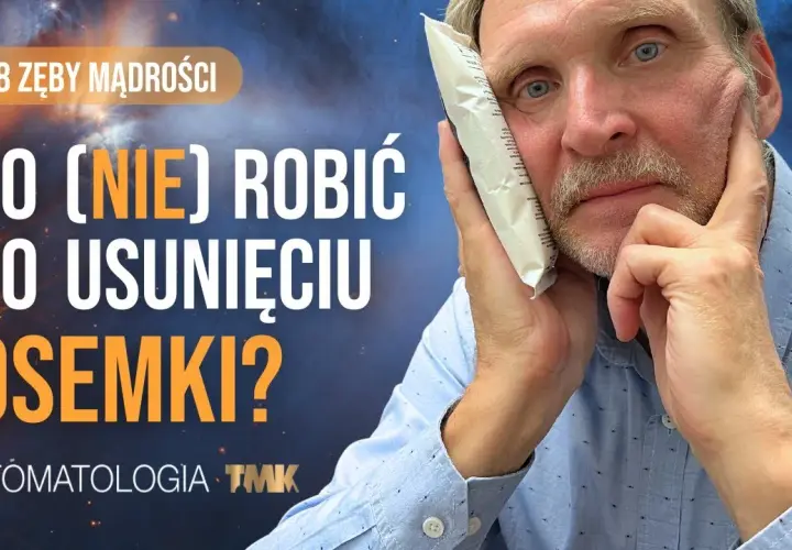 Koszt zdjęcia szwów z dziąsła: 50-150 zł? Czy zawsze płacisz?