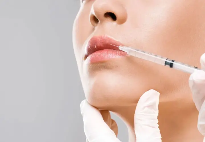 Dalle mani di un'estetista a quelle di un medico estetico: un primo piano di labbra che ricevono un trattamento di filler con siringa.