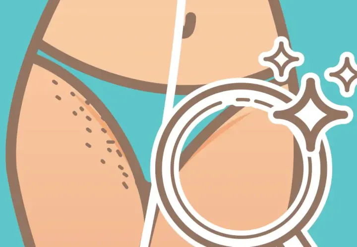 Jak golić miejsca intymne żeby były gładkie? Ilustracja pokazuje porównanie skóry przed i po depilacji, z lupą podkreślającą efekt gładkości.