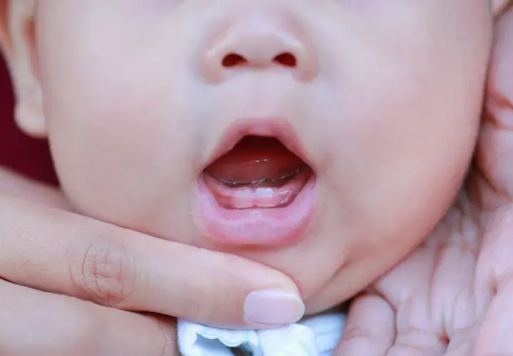 Le prime gemme dei denti dei bambini spuntano, un piccolo sorriso che promette tante scoperte.