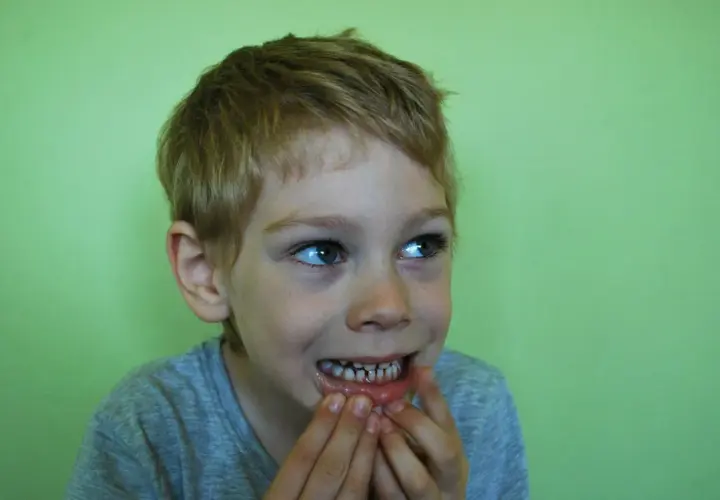 Bambino con denti sensibili, cerca un rimedio immediato.