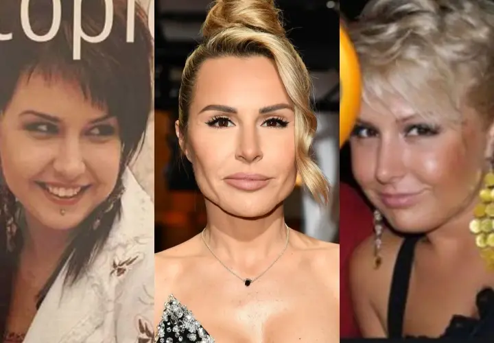 Trzy zdjęcia Blanka Lipińska przed operacjami. Widoczna metamorfoza twarzy i stylu.