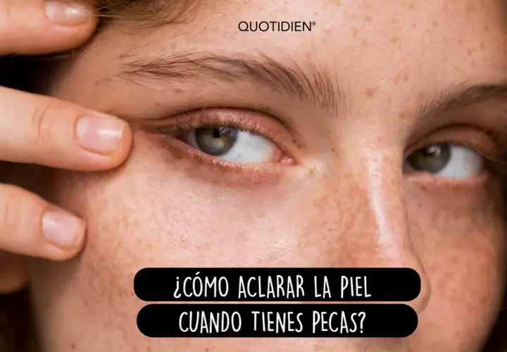 Primer plano de un ojo y mejilla con pecas. Un dedo tira suavemente de la piel del párpado inferior. Texto: "¿Cómo aclarar la piel cuando tienes pecas?".