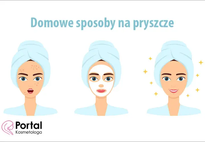 Co jest dobre na pryszcze? Sprawdzone metody i porady eksperta