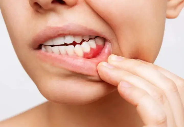 Gengive infiammate e mal di stomaco: un disagio che colpisce tutto il corpo.