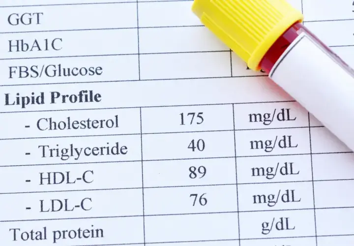 Wynik lipidogramu: cholesterol całkowity 175 mg/dL, HDL 89 mg/dL, LDL 76 mg/dL. Wartość cholesterolu nie-HDL jest podwyższona.