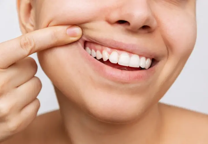 Dito con un dito, un sorriso mostra denti bianchi e **gengive normali**, segno di buona salute orale.